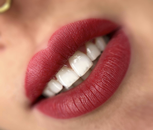 LABIOS
